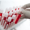 artificial-intelligence-flickr-310px blood sampling