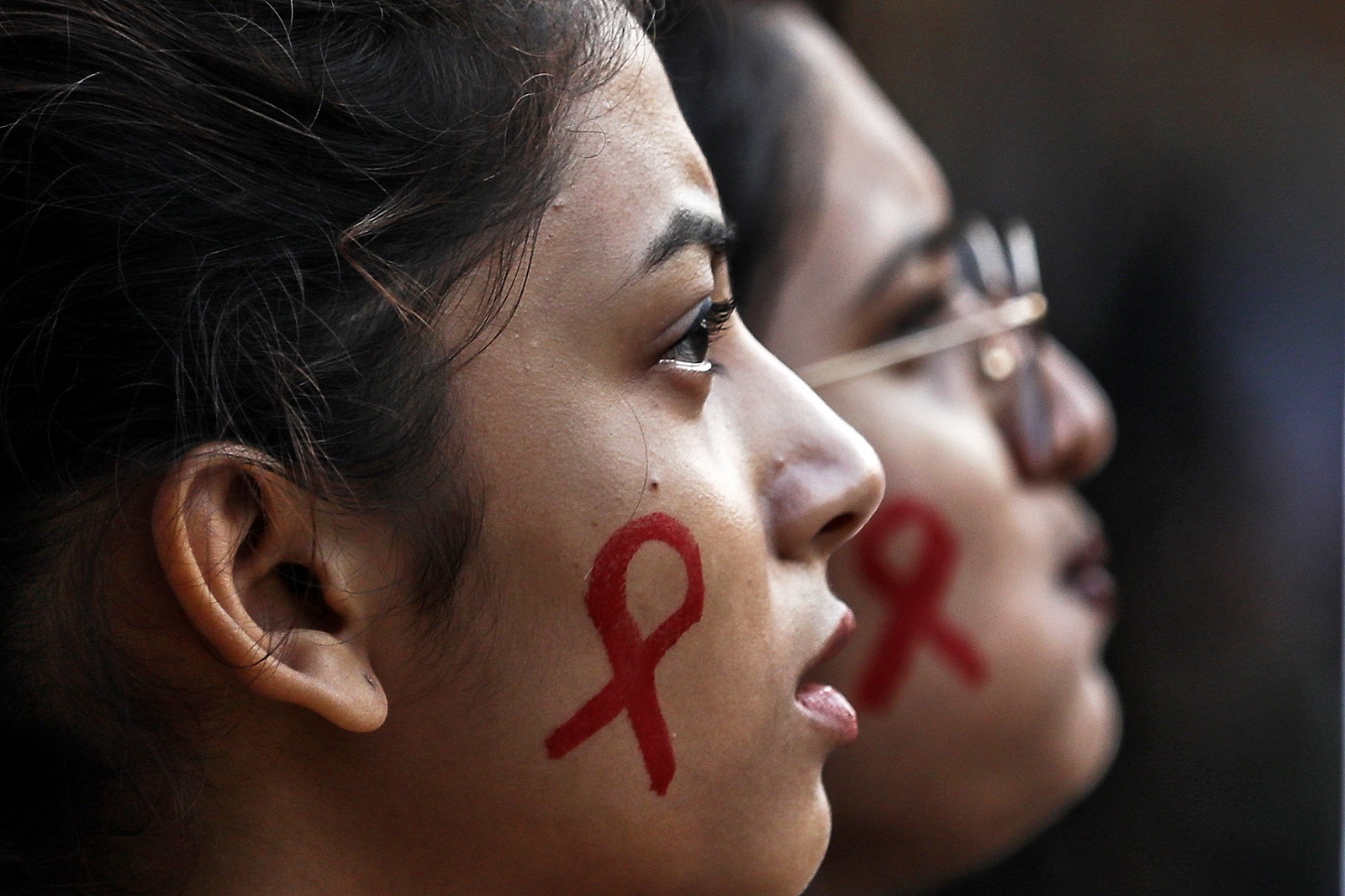 HIV HIV