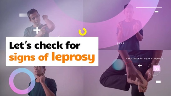 let check leprosy yourself