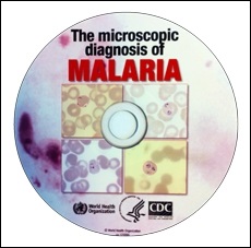 The microscopic diagnosis of malaria