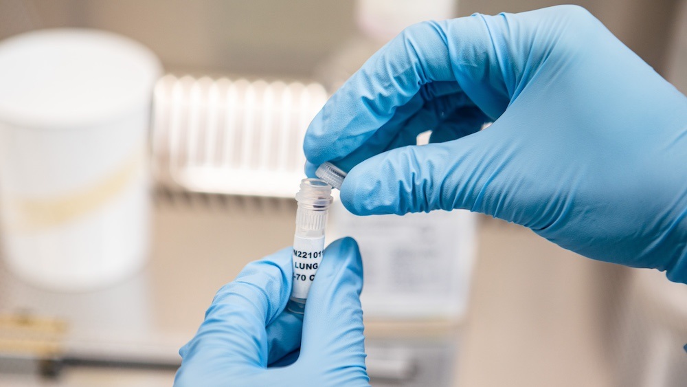 MERS-CoV virus isolate added to the WHO BioHub System, enabling further research and pandemic preparedness – World Health Organization (WHO)