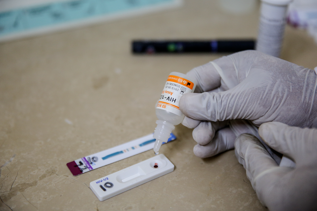 HIV_in_vitro Rapid In vitro test, being used