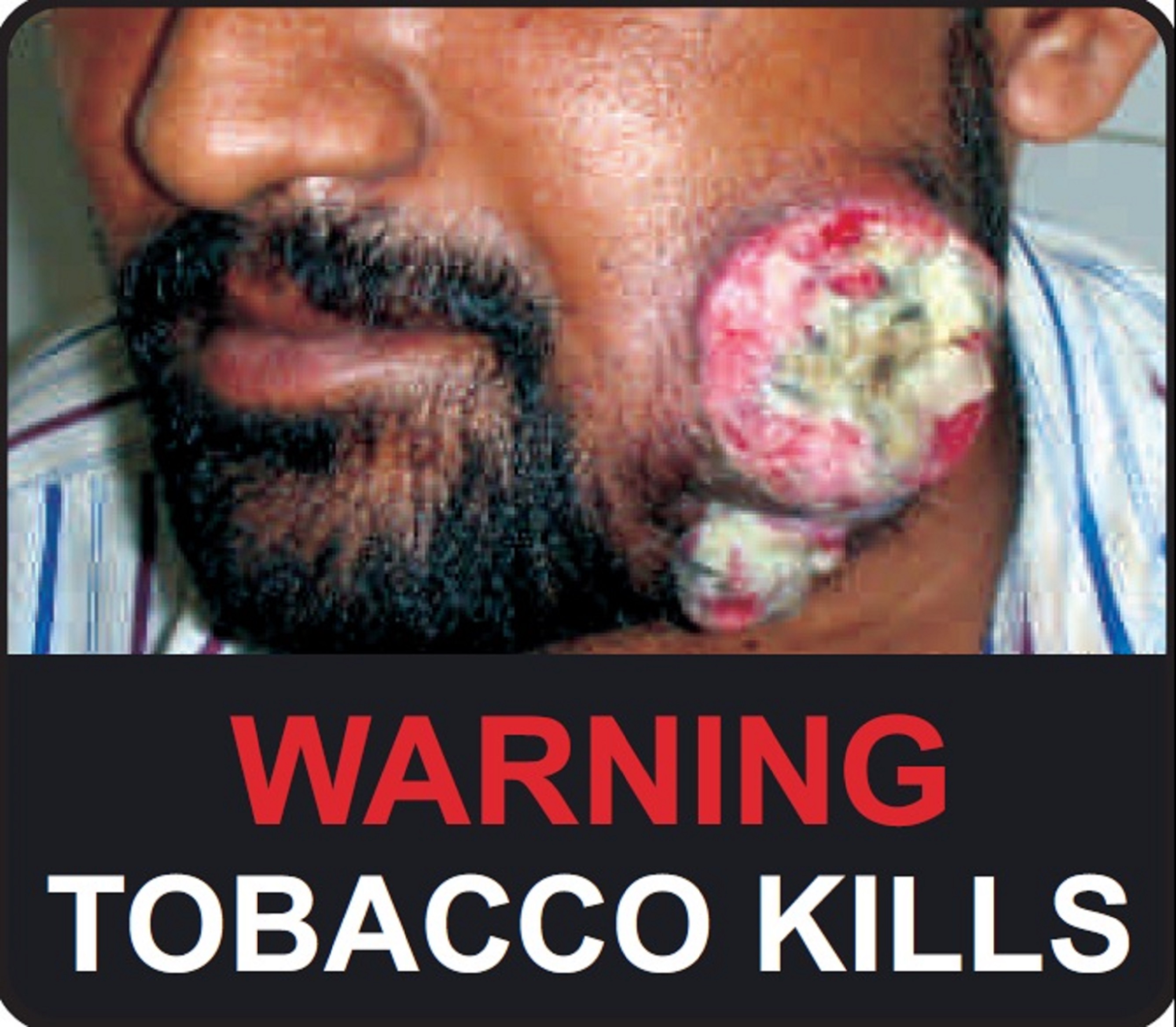 Warning - Tobacco kills - image 1
