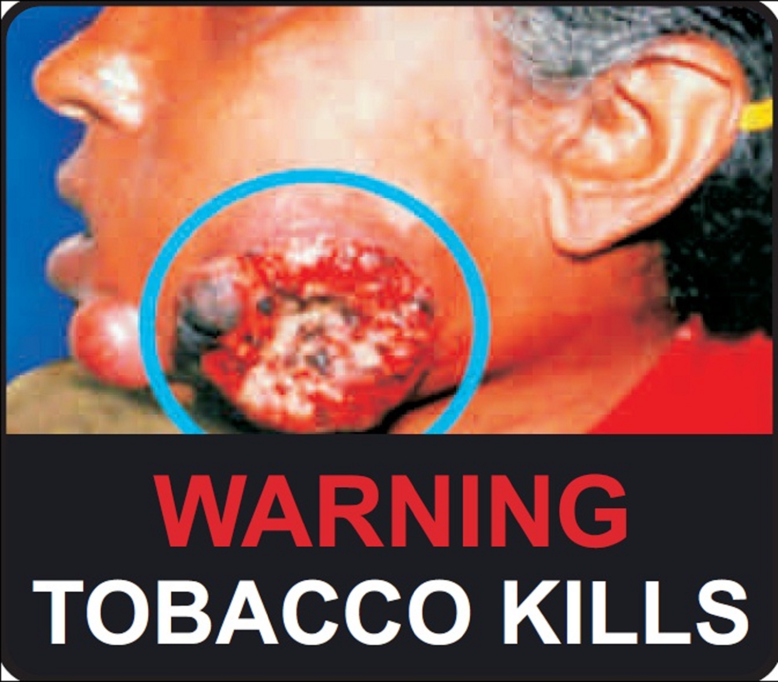 Warning - Tobacco kills - image 2
