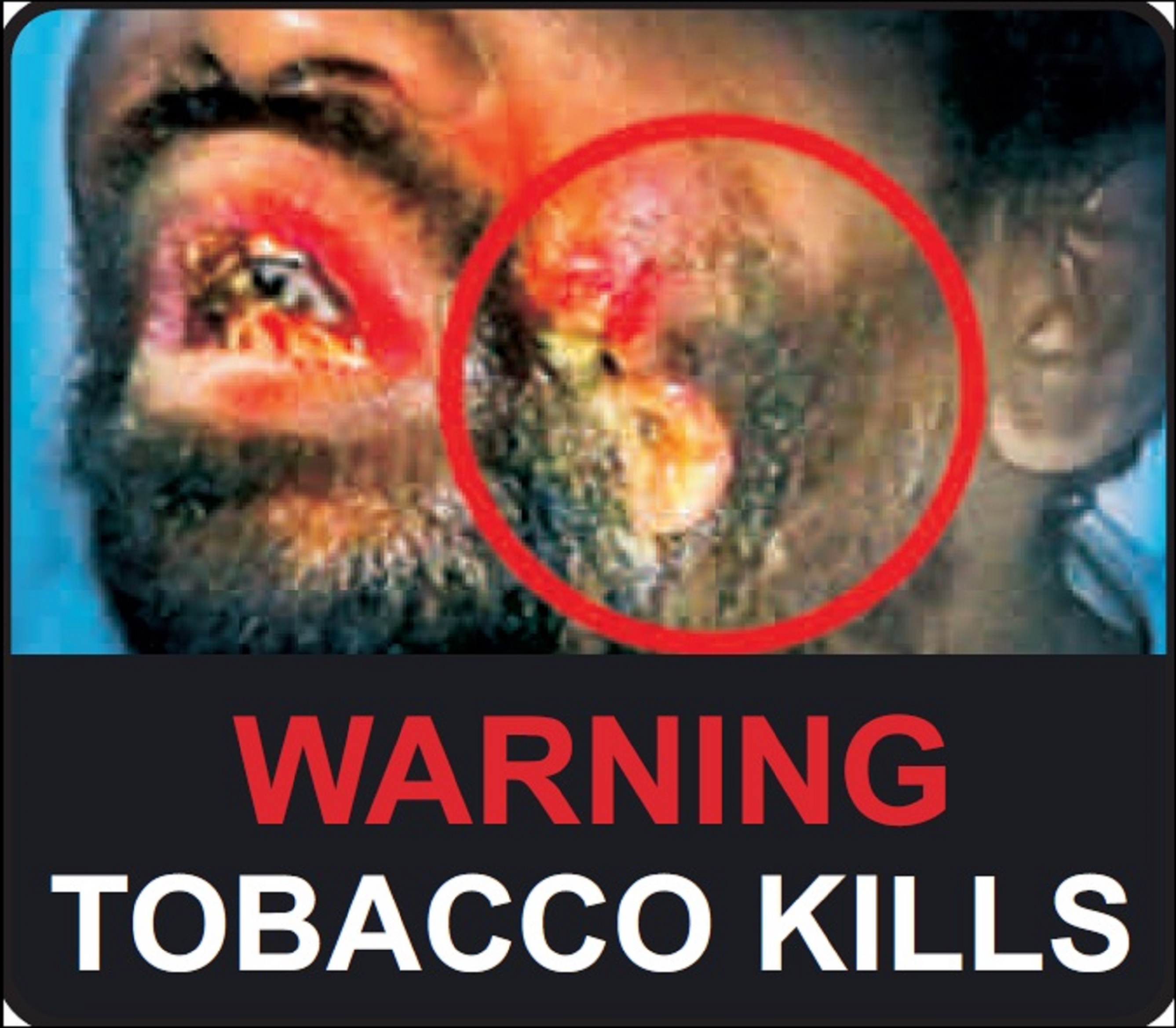 Warning - Tobacco kills - image 3