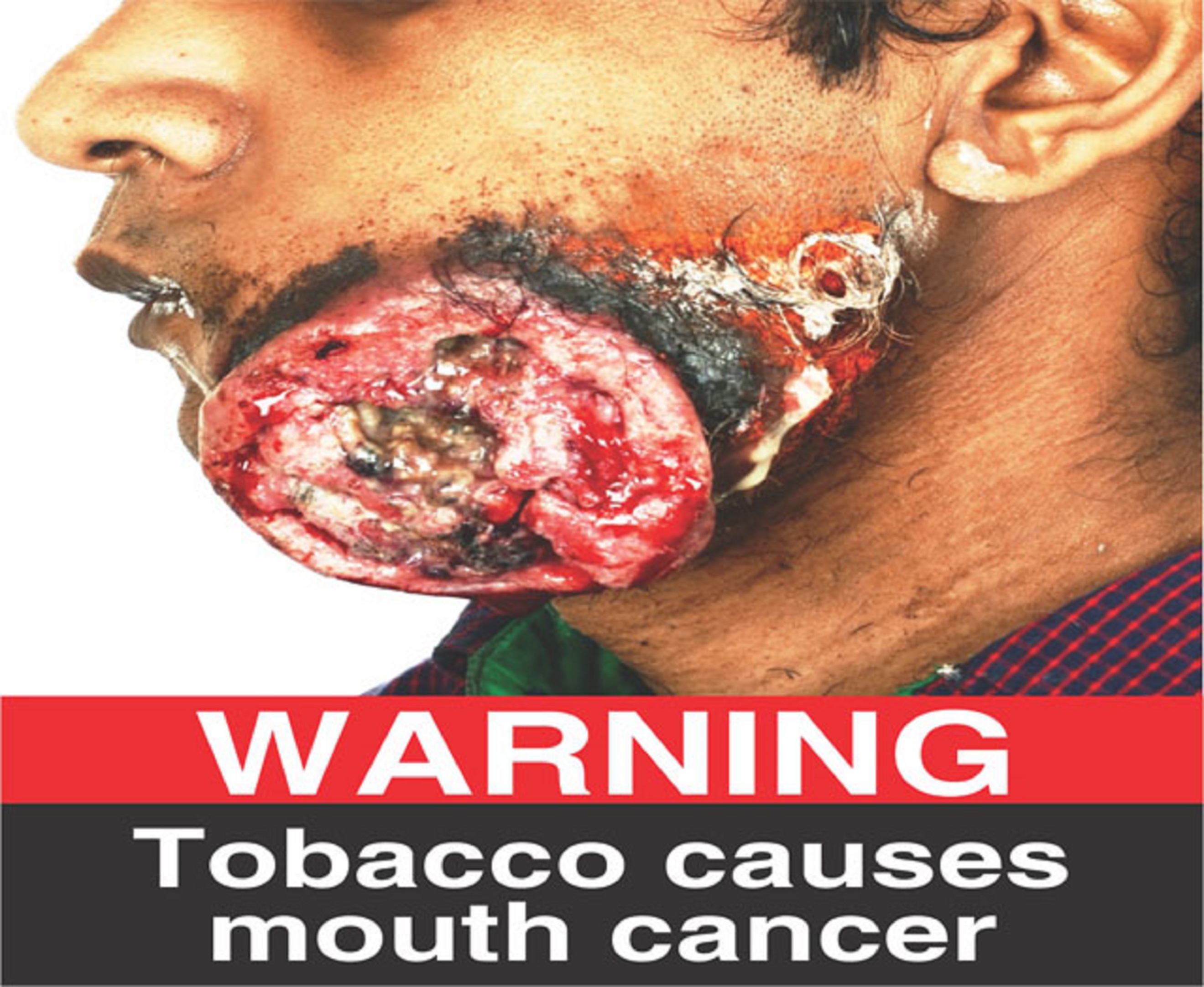 tobacco causes cancer