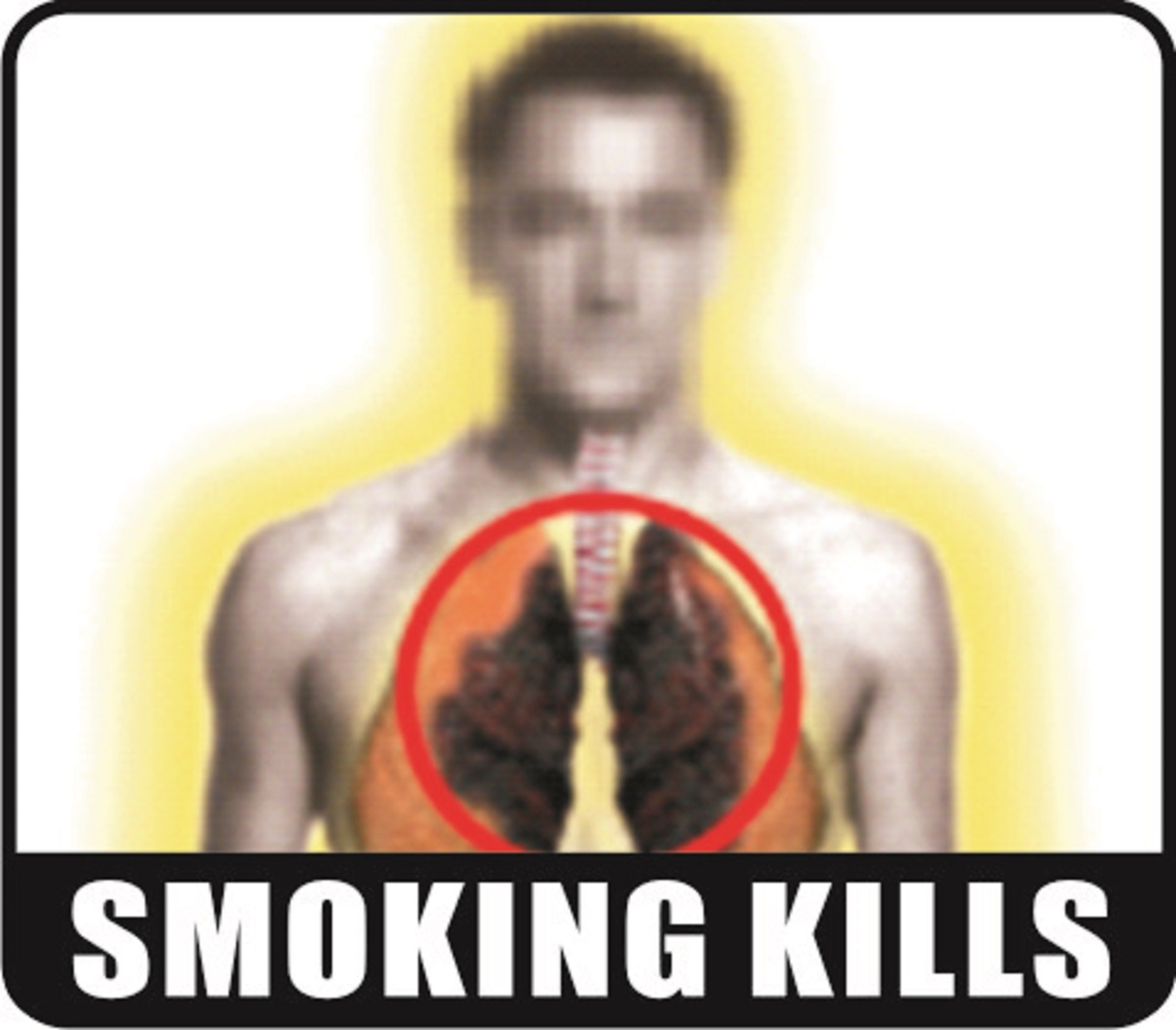 Smoking kills image 2
