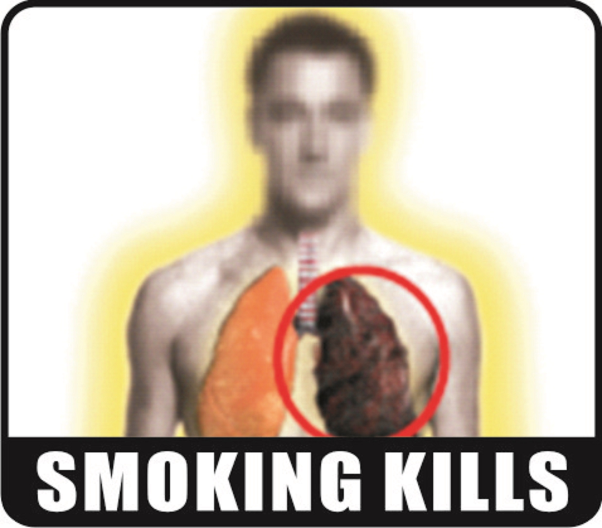Smoking kills - image 3