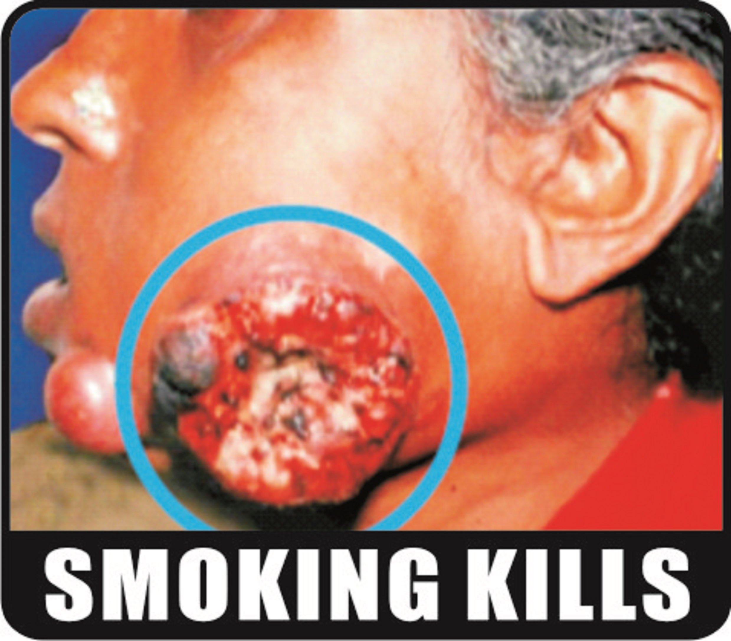 Smoking kills - image 4