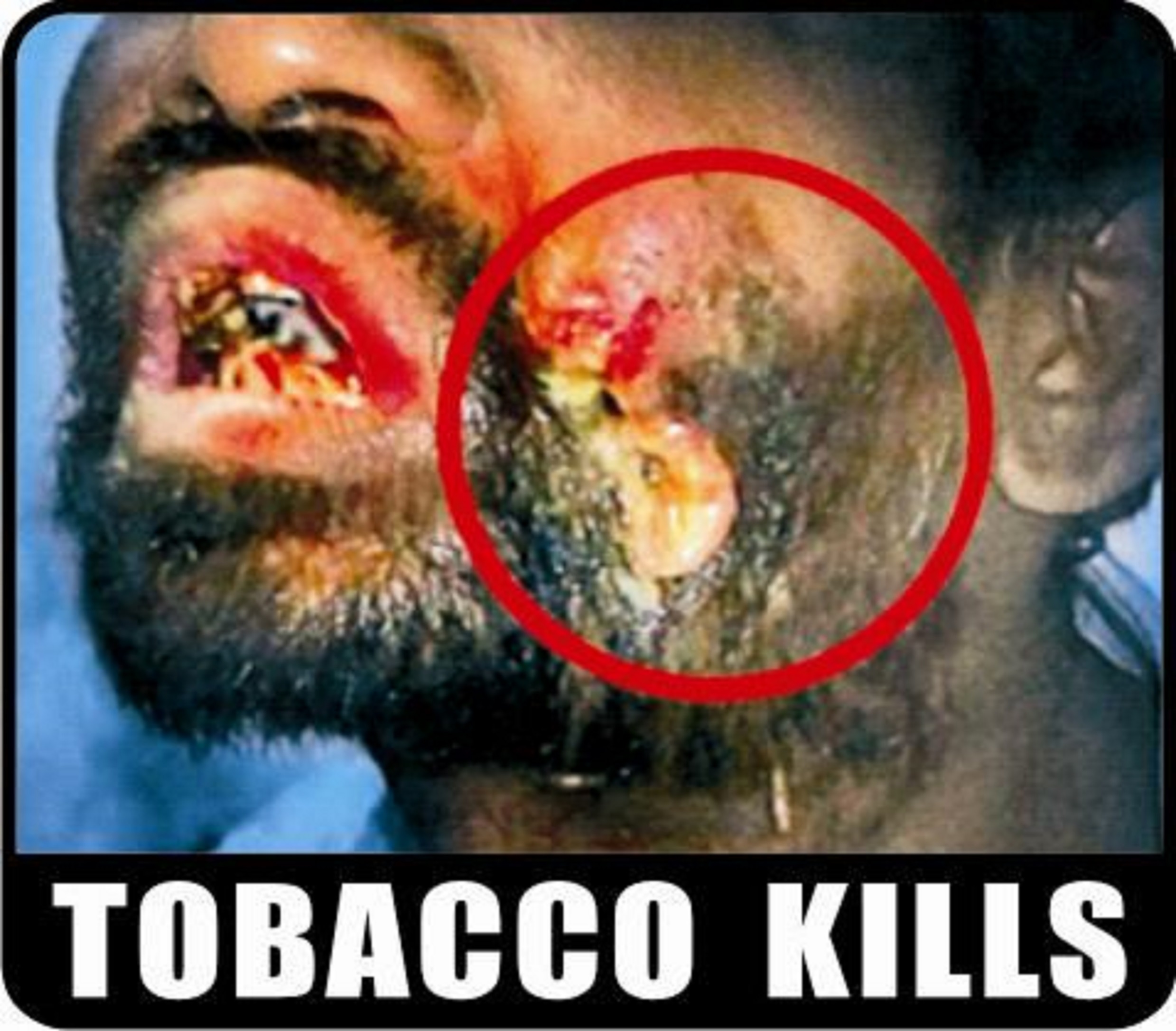 Tobacco kills - image 1