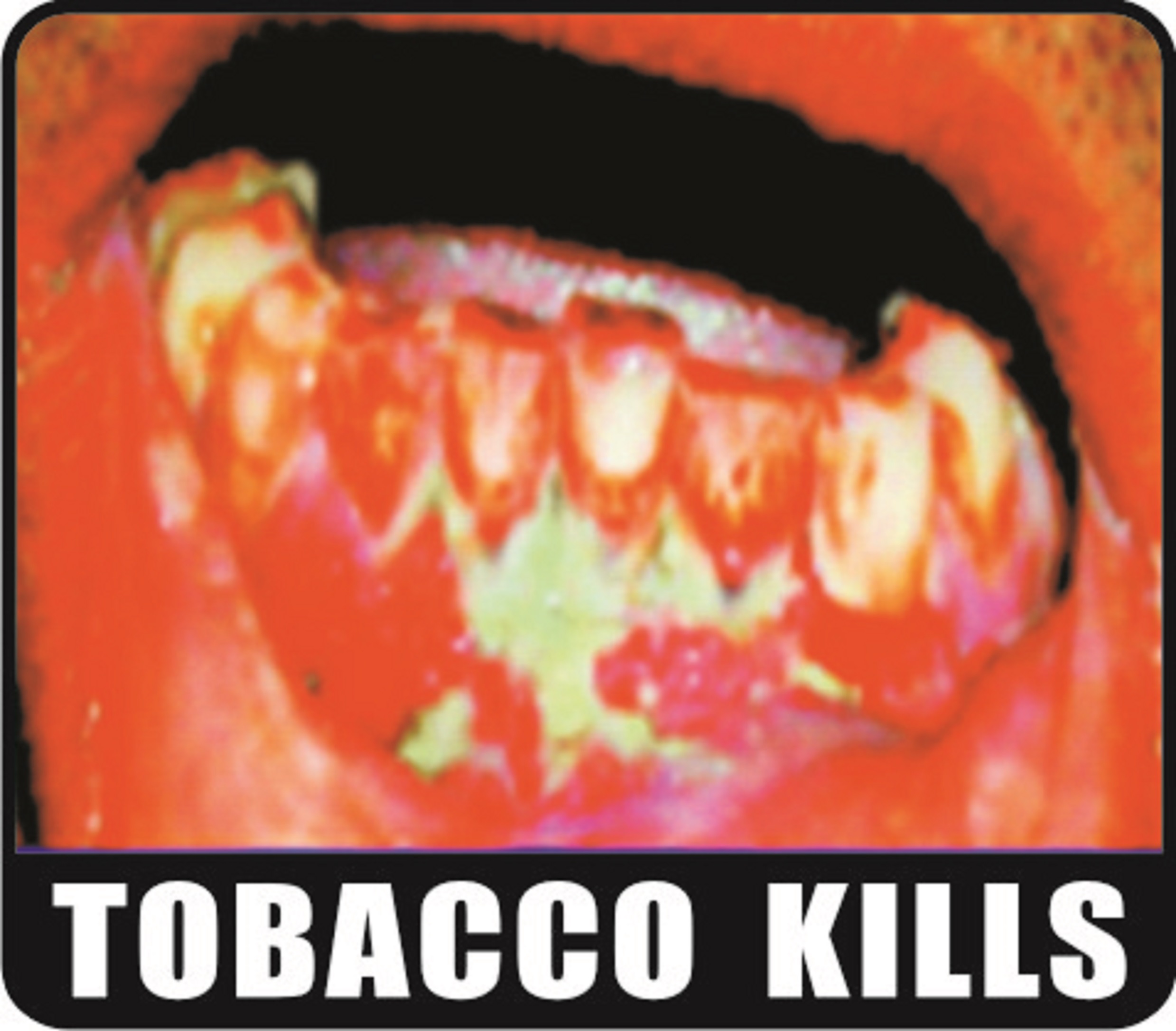 Tobacco kills - image 2
