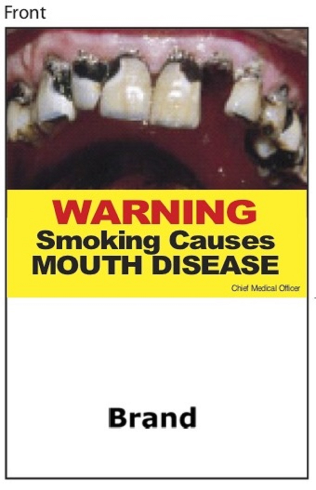 Smoking causes mouth disease