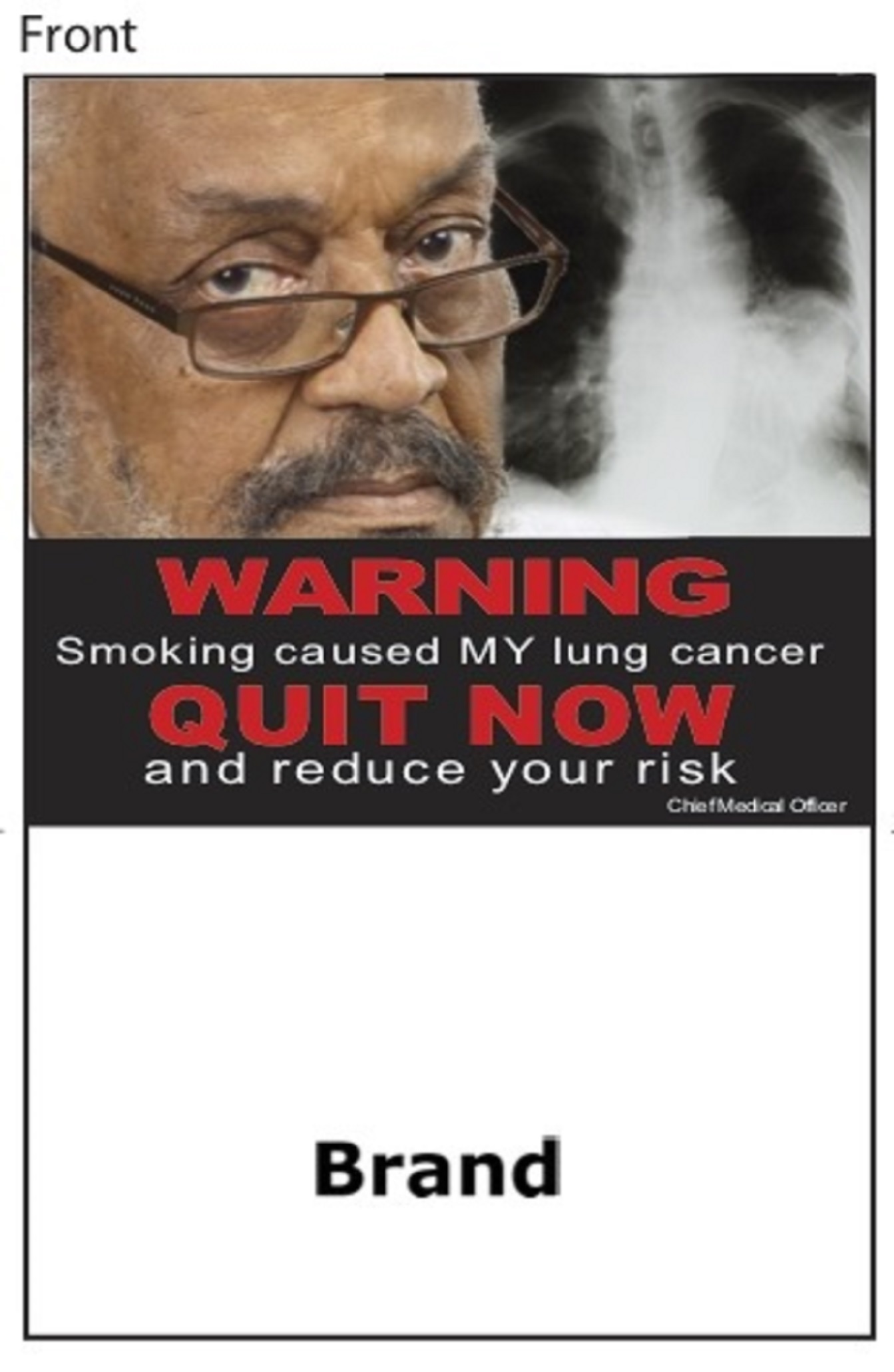 Smoking caused my lung cancer - Quit now and reduce your risk