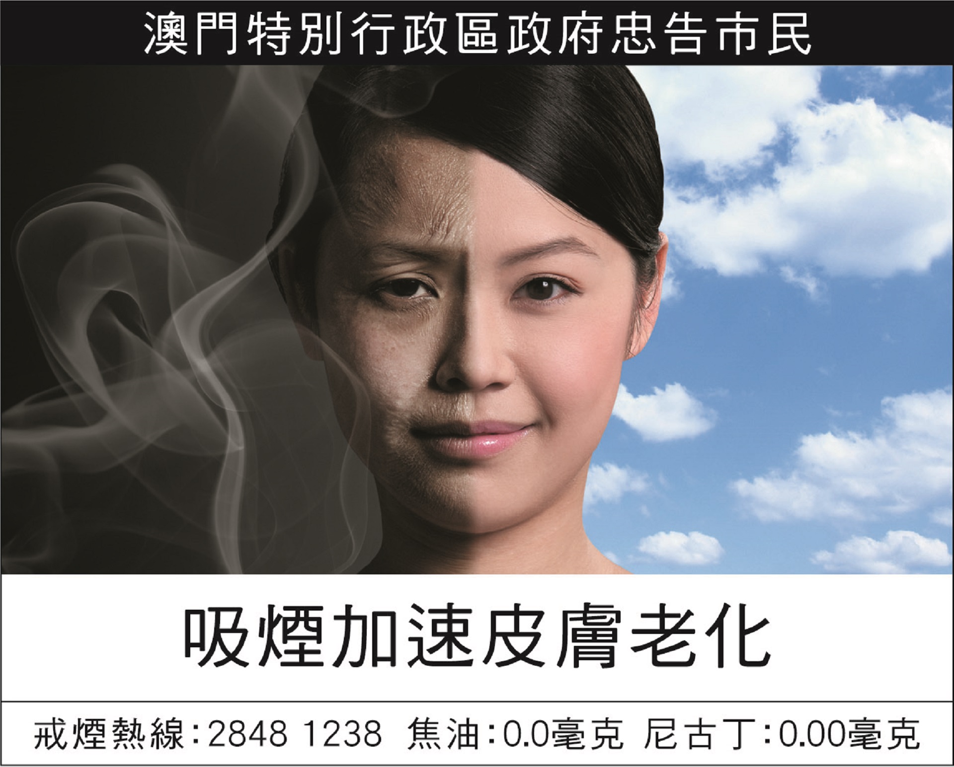 Smoking Can Accelerate Aging Of Skin