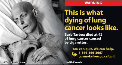 This is what dying of lung cancer looks like.