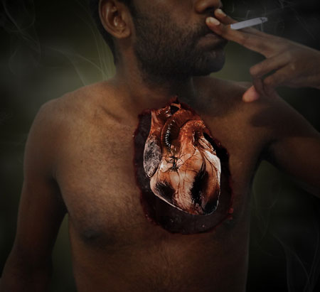 Smoking causes heart diseases