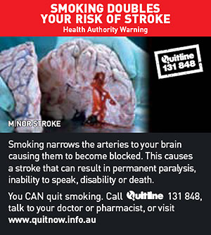 Smoking doubles your risk of stroke - Back of pack