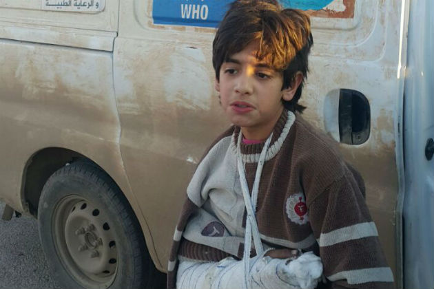 A young boy with a broken arm stands outside a van.