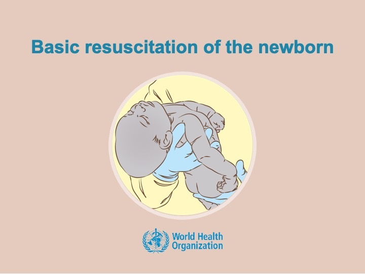 Basic resusication Basic resuscitation