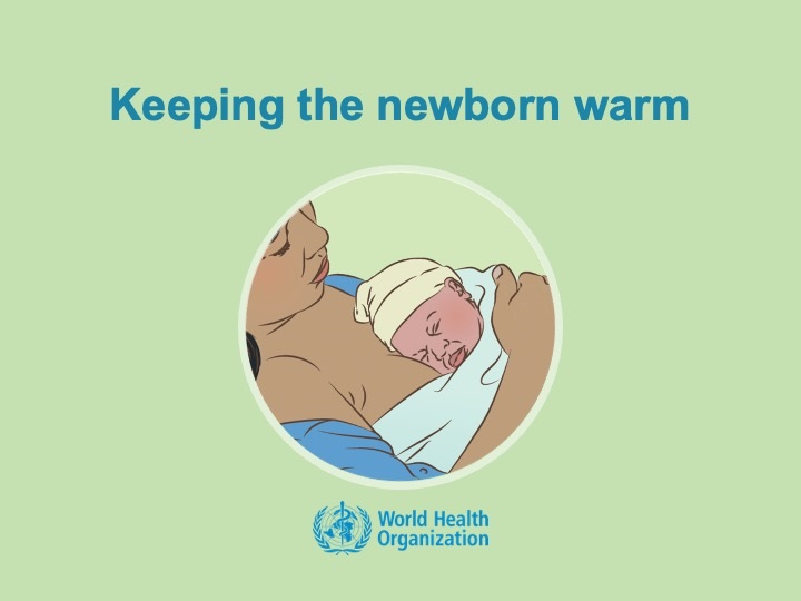 Keeping the newborn warm Keeping the newborn warm