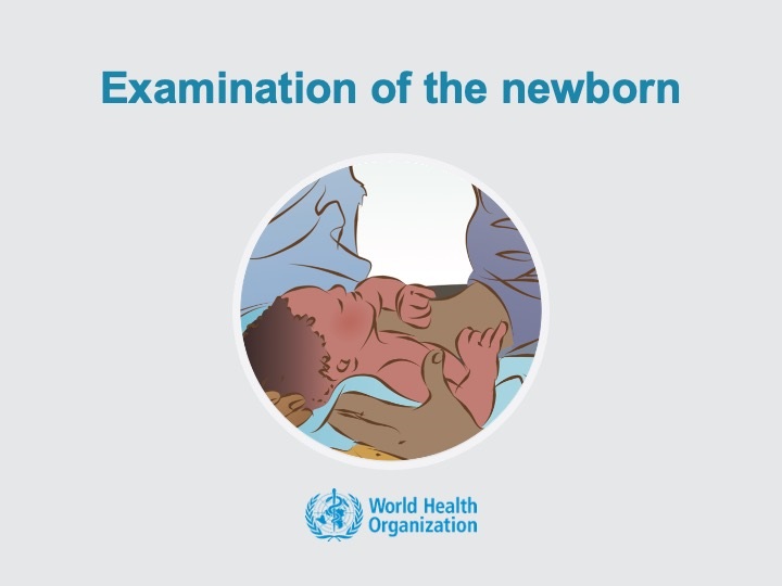 Examination Examination of the newborn