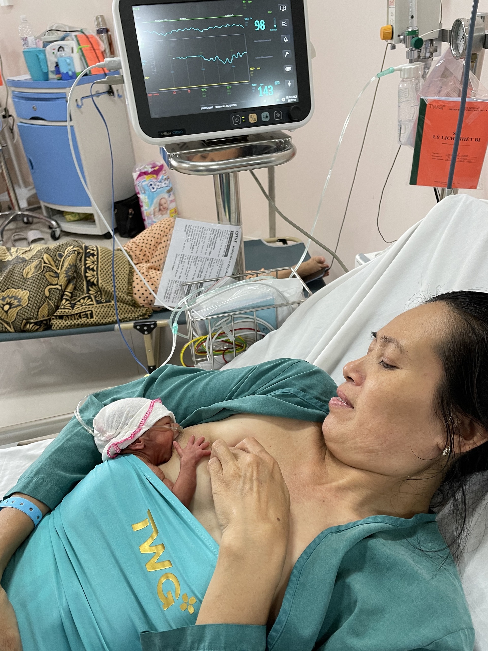 A mother breastfeeds her newborn in KMC position A mother and her newborn baby in a hospital setting while the mother provides KMC.