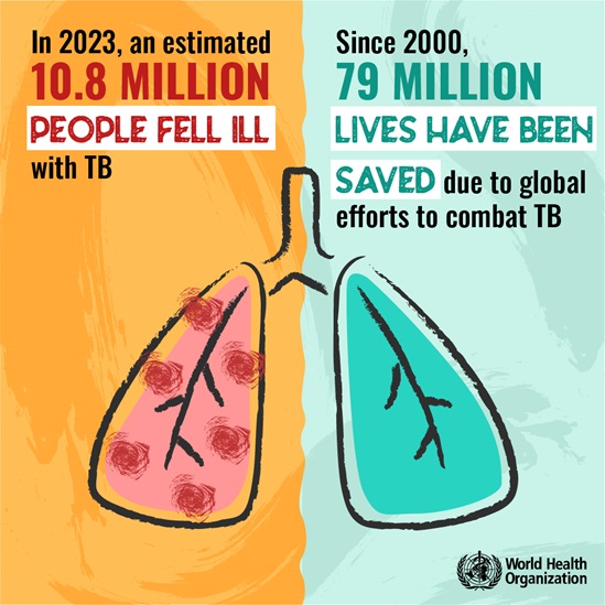 健康・医学 Tuberculosis Clinical Overview of Tuberculosis Disease | Tuberculosis (TB