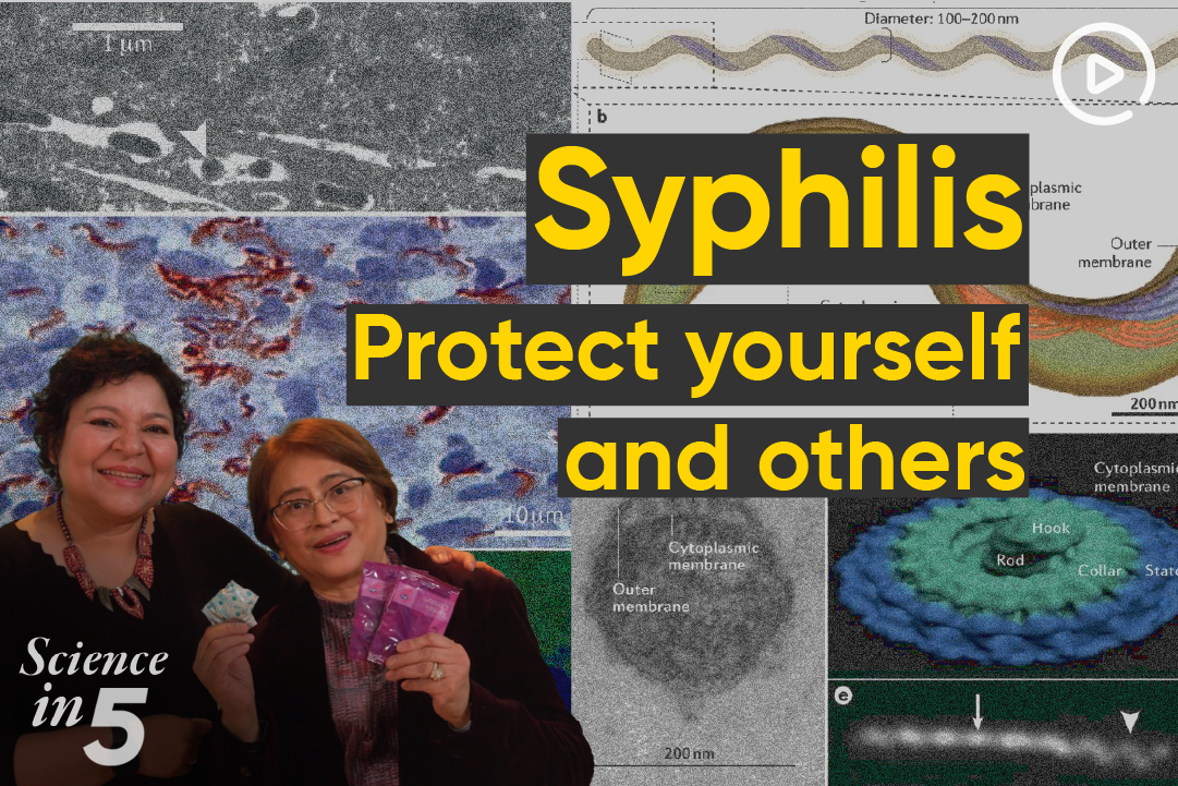 Science in 5 podcast - Syphilis, protect yourself and others