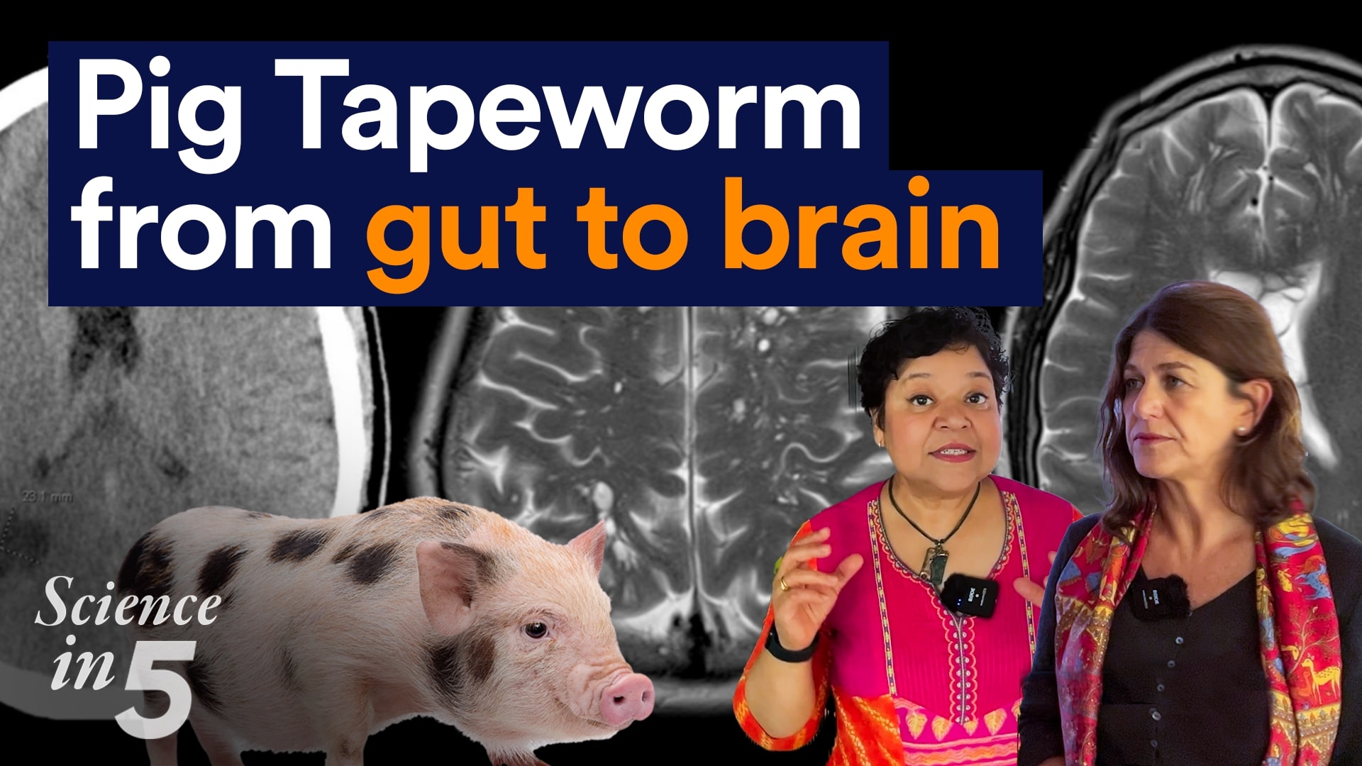 Science in 5 - Ep145 Pig Tapeworm Science in 5 podcast - Pig Tapeworm: from gut to brain