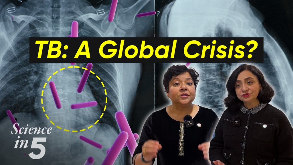 Podcast: Science in 5: "TB: A Global Crisis?".