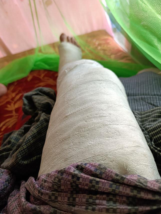 injured during the recent Myanmar earthquake