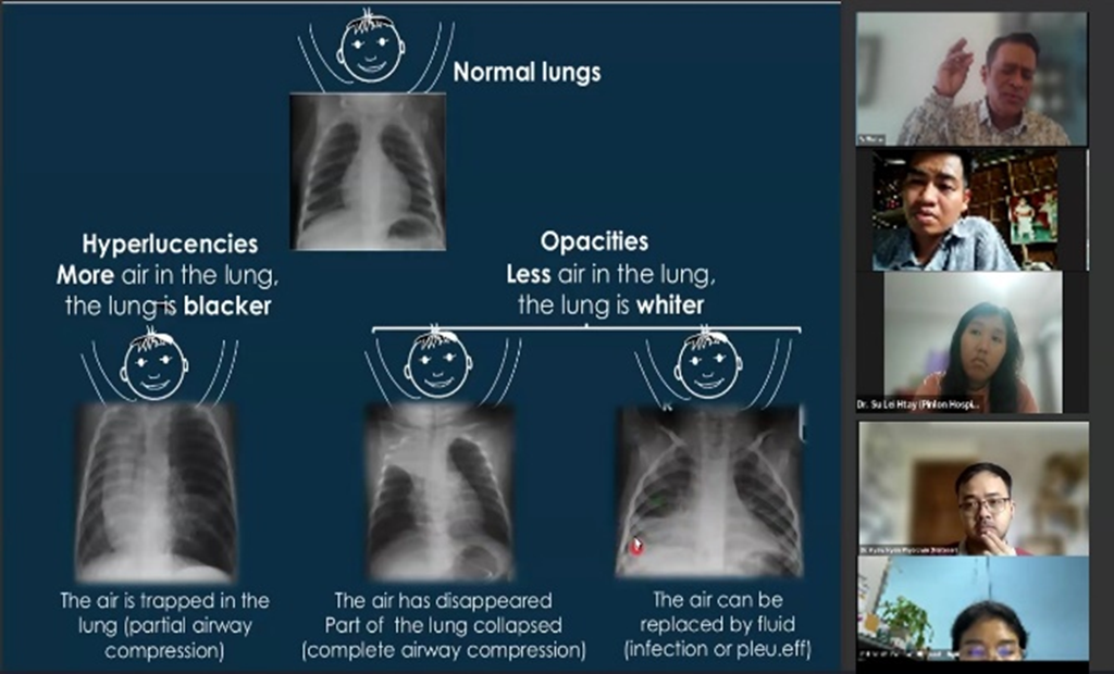 virtual training on Chest X-ray interpretation