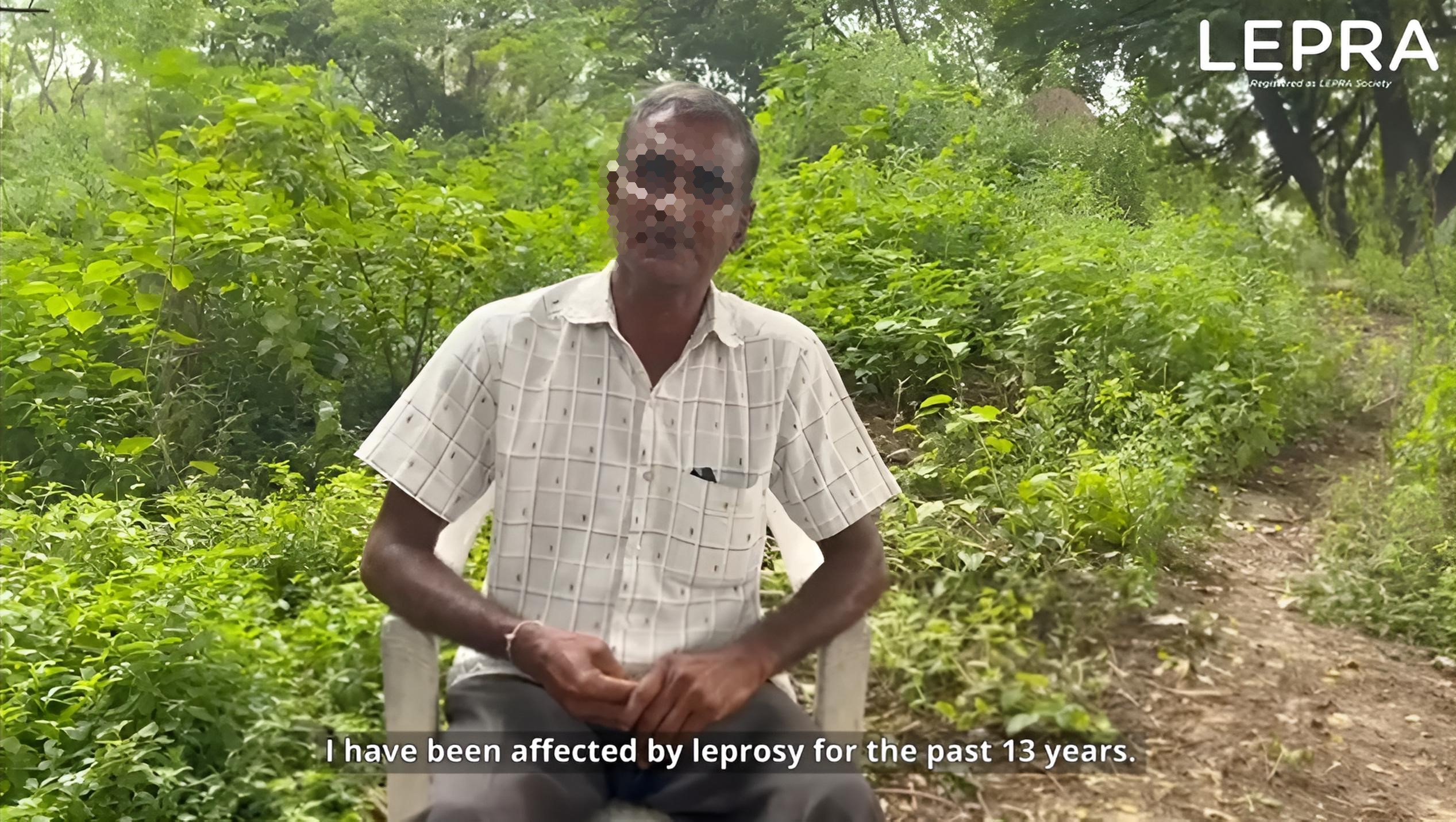 A recipient of the customized footwear made by the LEPRA Society