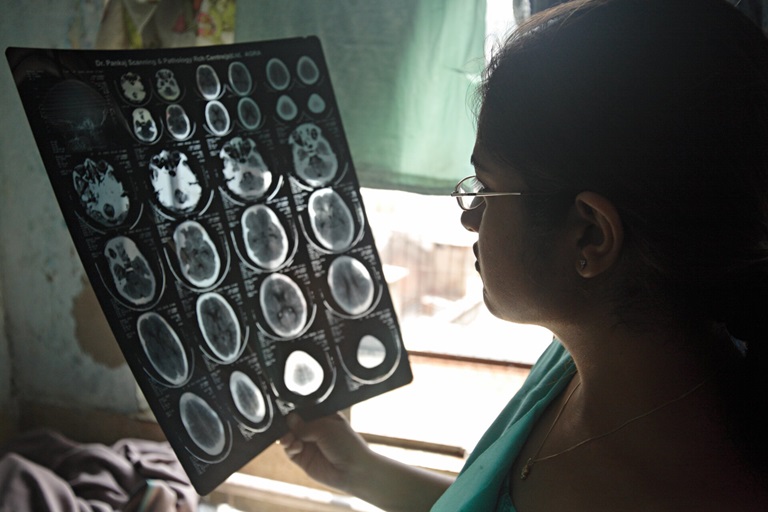 11 Million Lives Lost Each Year: Urgent Action Needed On Neurological Care 11 Million Lives Lost Each Year: Urgent Action Needed On Neurological Care