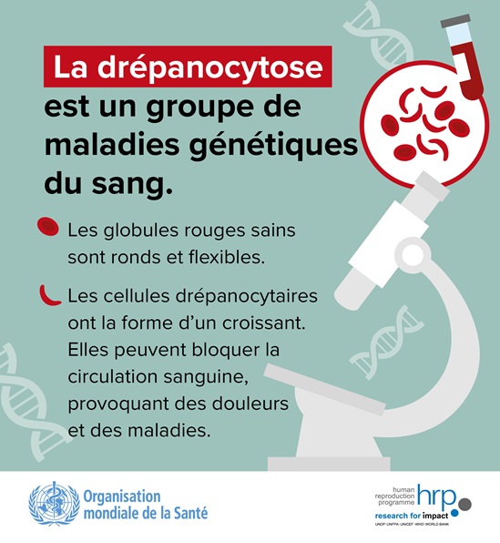 La drépanocytose est un group de maladies génétiques du sang. Les globules rouges sains sont ronds et flexibles. Les cellules drépanocytaires ont la forme d'un croissant.