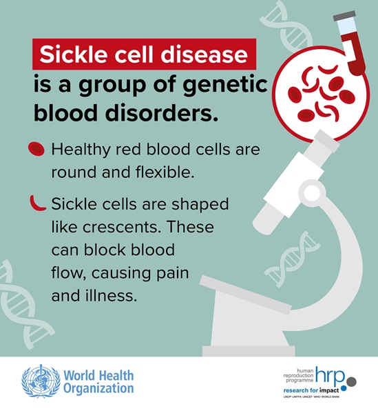 Sickle cell disease is a group of genetic blood disorders.  Healthy red blood cells are round and flexible. Sickle cells are shaped like crescents. These can block blood flow, causing pain and illness.
