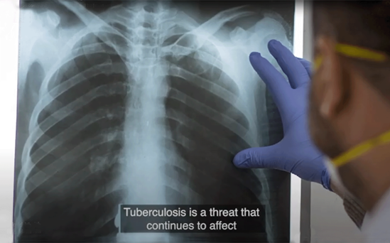 Tuberculosis: Guidance on community engagement