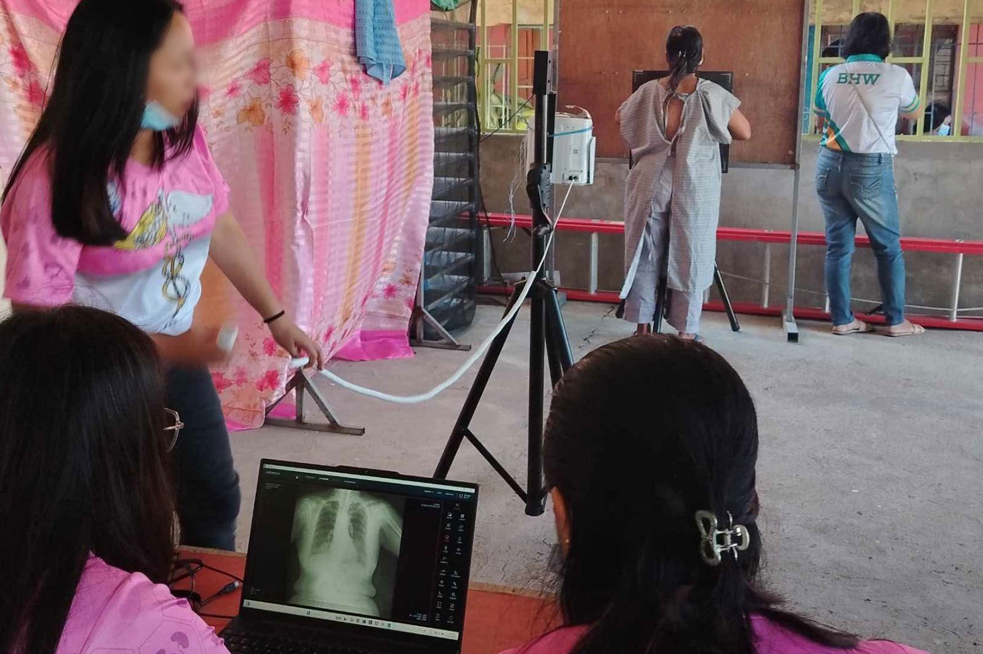 AI powered portable X-ray