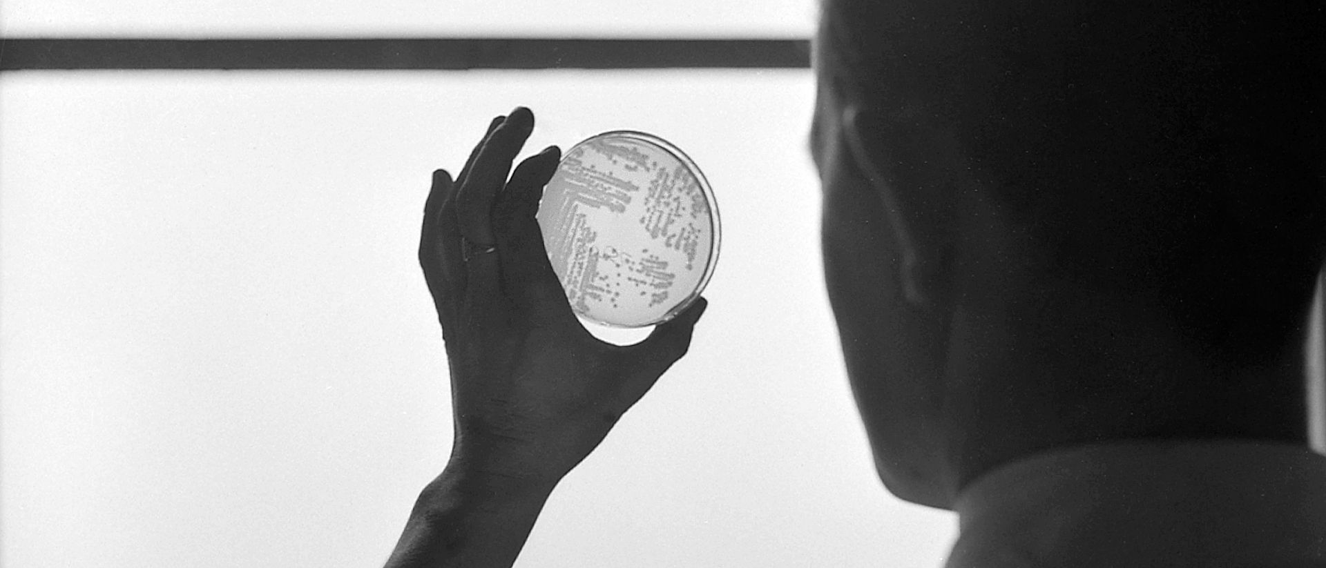 A laboratory technician is examinating a bacteria culture holding it up against a window.