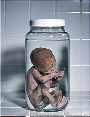 Smoking causes miscarriages.